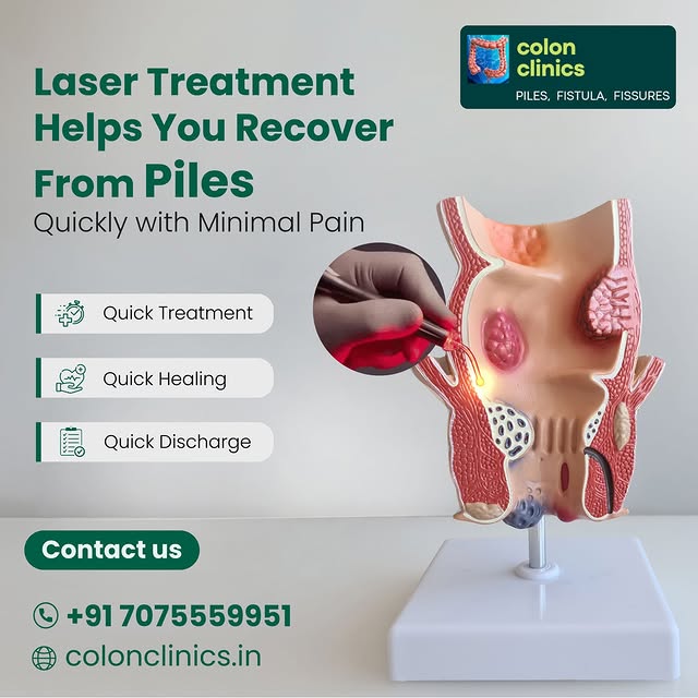 Vizag Laser Piles Center